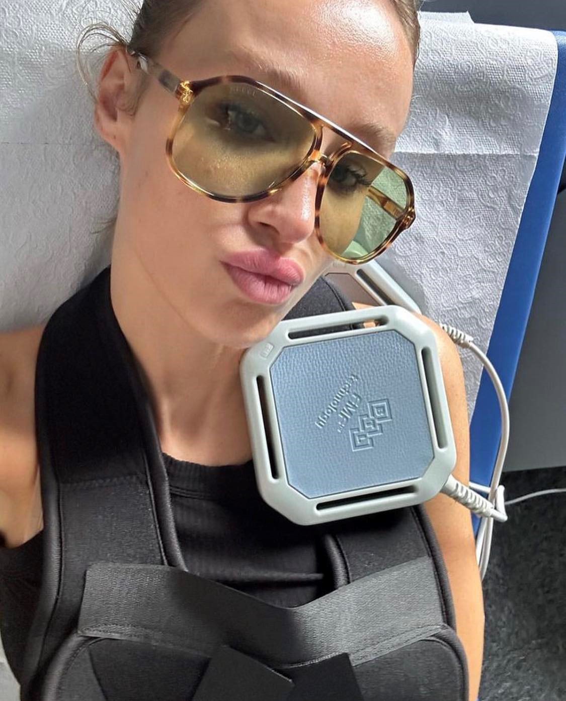 " მთლიანი ტანით დავეცი მარცხენა ბეჭზე ... 4 კვირის მანძილზე ასე ვიქნები" - ანუკი არეშიძე მიღებული ტრავმის შესახებ